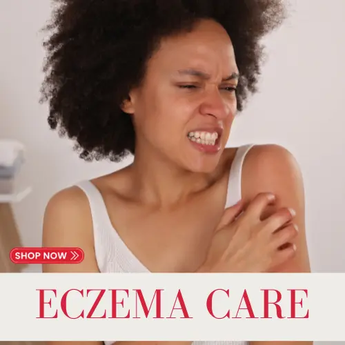 donkey milk cream eczema