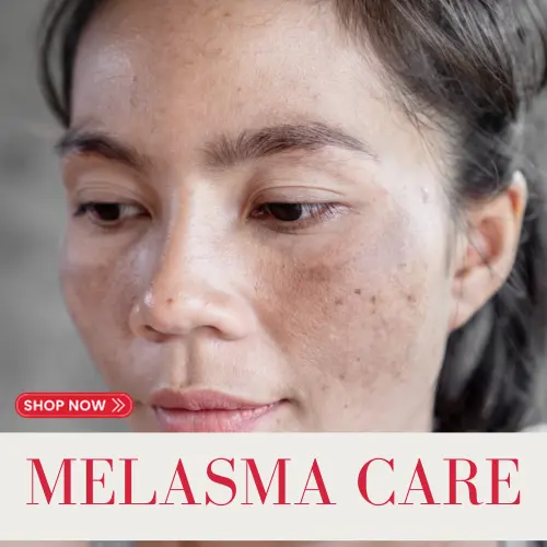 donkey milk pigmentation cream