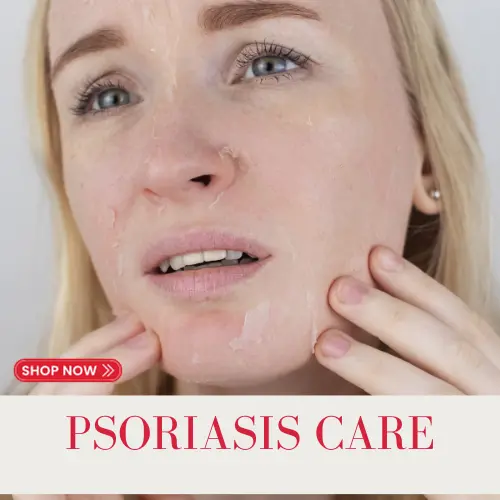 donkey milk psoriasis treatment