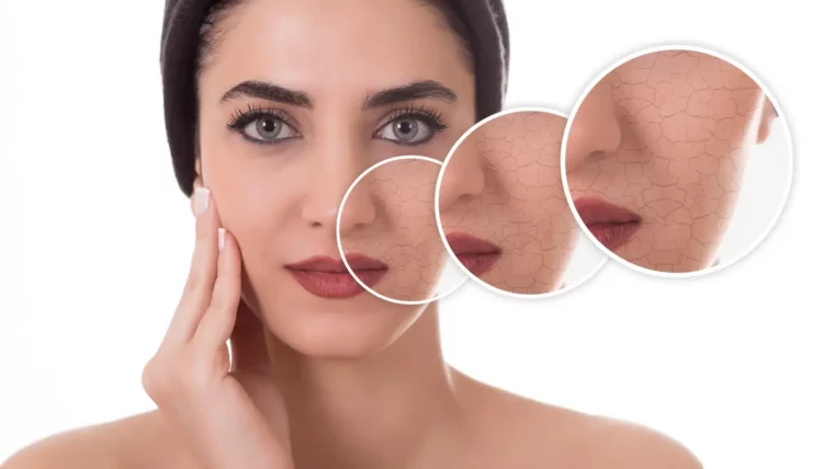 heal dry skin on the face